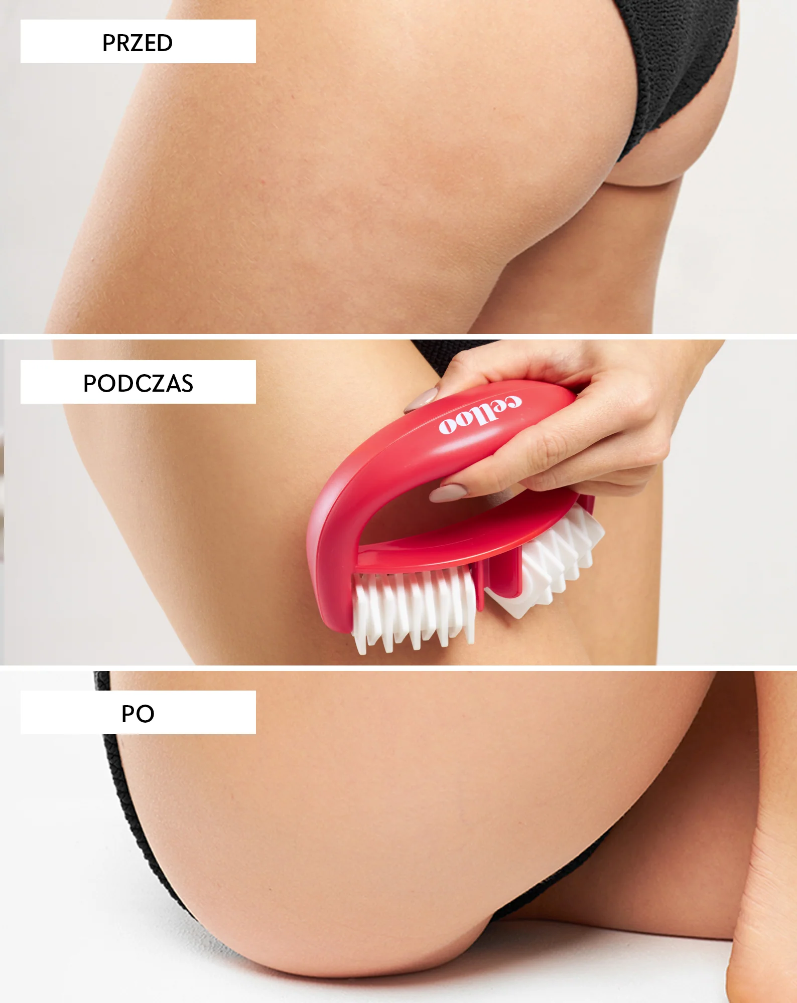 Masażer antycellulitowy z wypustkami zwalcza cellulit i zmniejsza napięcie mięśni Crush my Celloo - Image 3