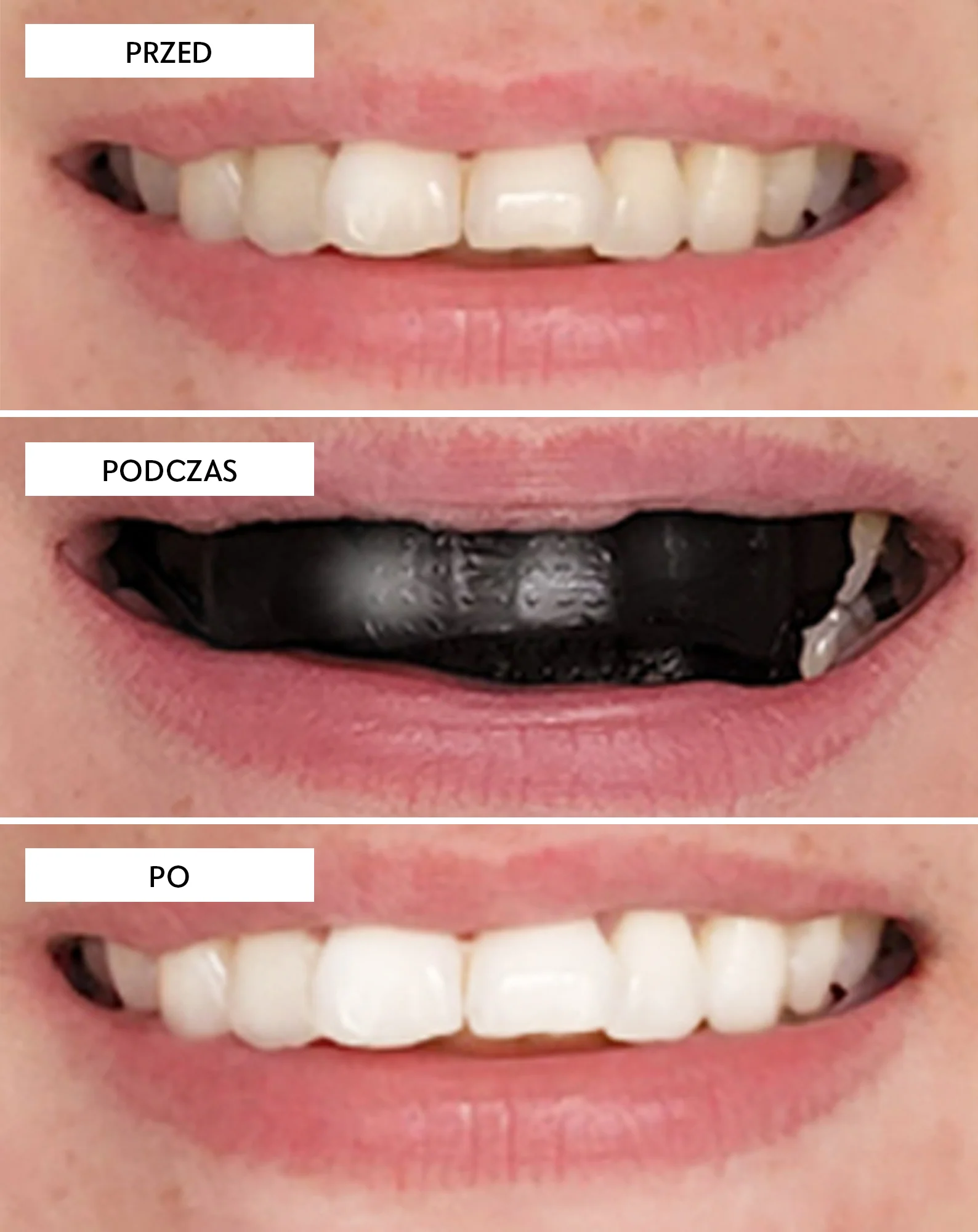 Paski wybielające zęby The White(ning) Stripes Smilebite zestaw 28 szt. - Image 3