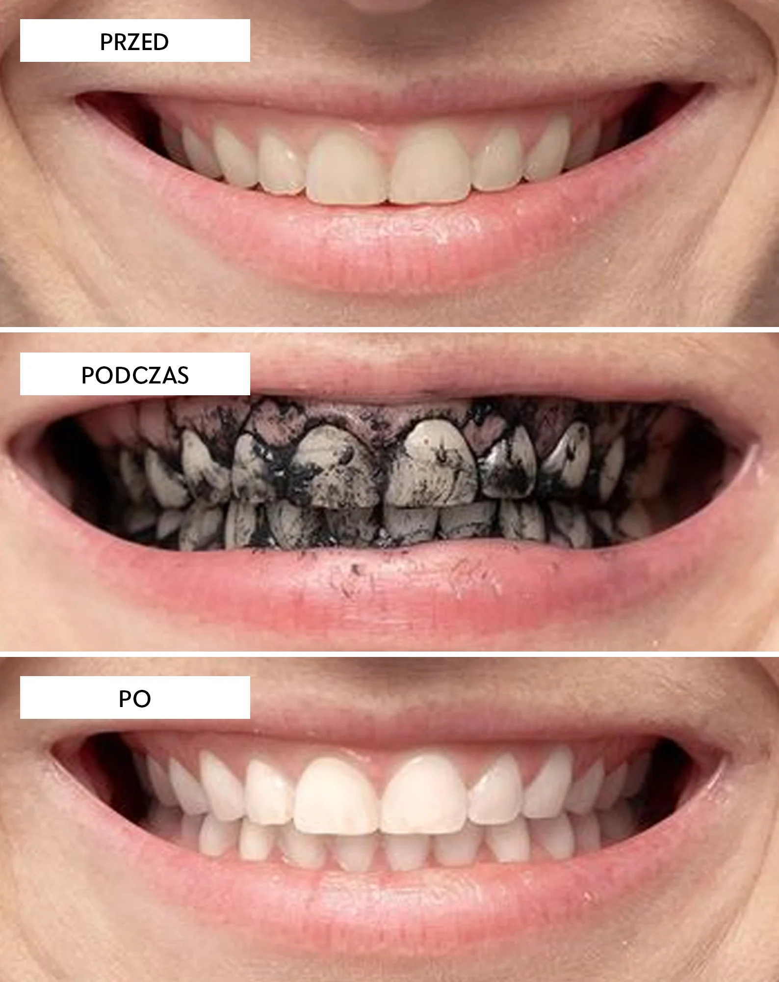 Proszek do wybielania zębów z węglem kokosowym Smilebite - Image 4