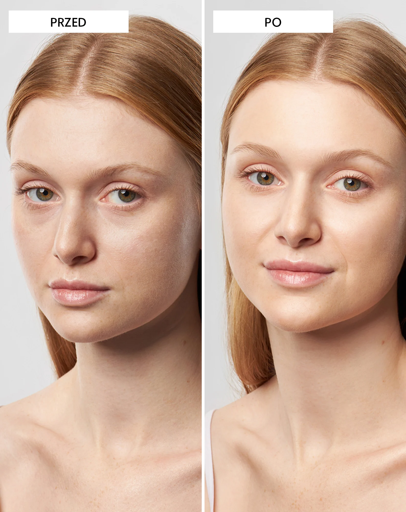 Ultranawilżające serum do twarzy z kwasem hialuronowym Mel Skin - Image 4