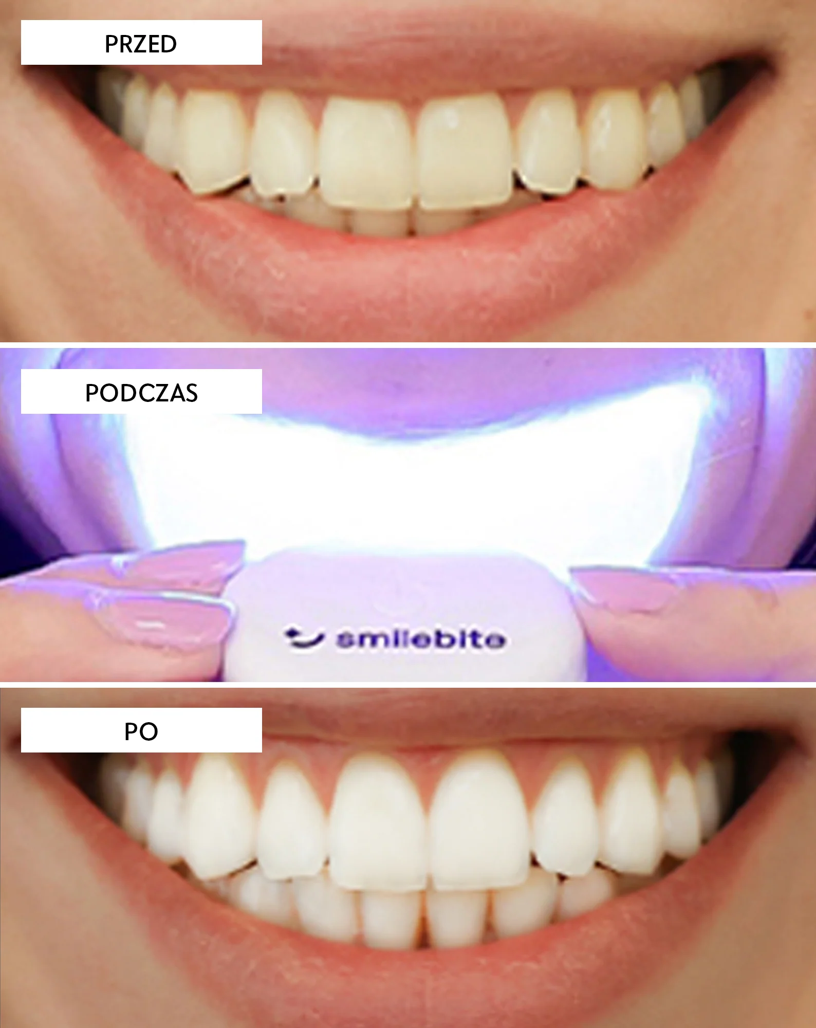Smilebite Light & Bright Zestaw do wybielania zębów lampa LED + Whitesmile Serum™ - Image 6