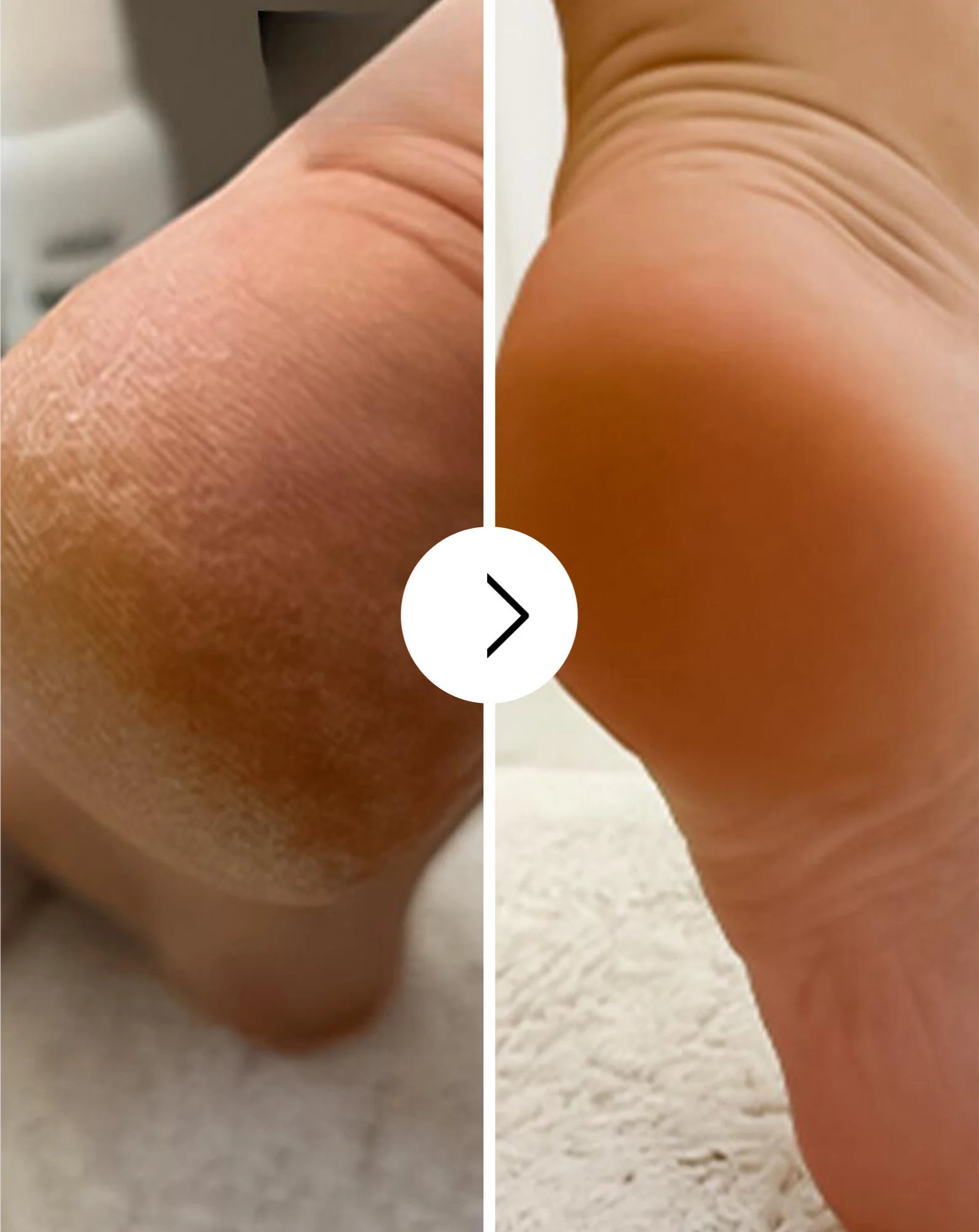 Zmiękczający krem do stóp z mocznikiem i masłem shea Nutridome - Image 4